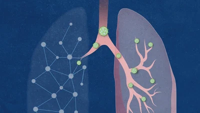 Artificial intelligence-guided design of lipid nanoparticles for pulmonary gene therapy featured image